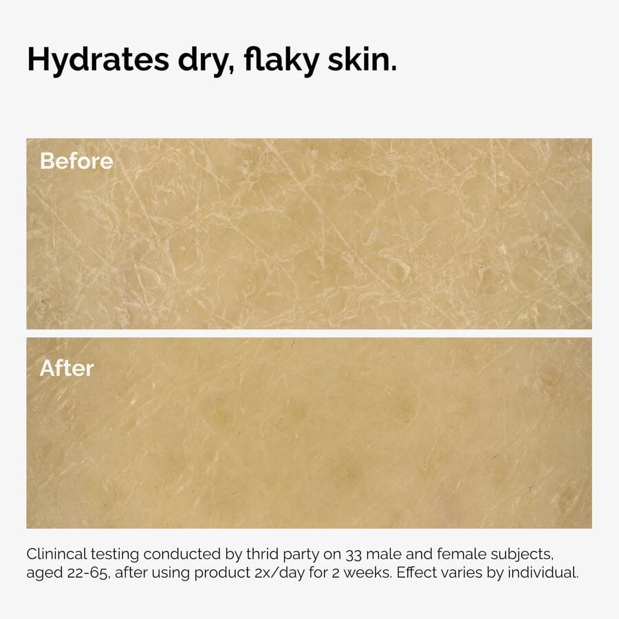 the-body-care-collection-p3 ord-natural-moisturizing-factors-inulin-body-before-after-graphic-02.jpg