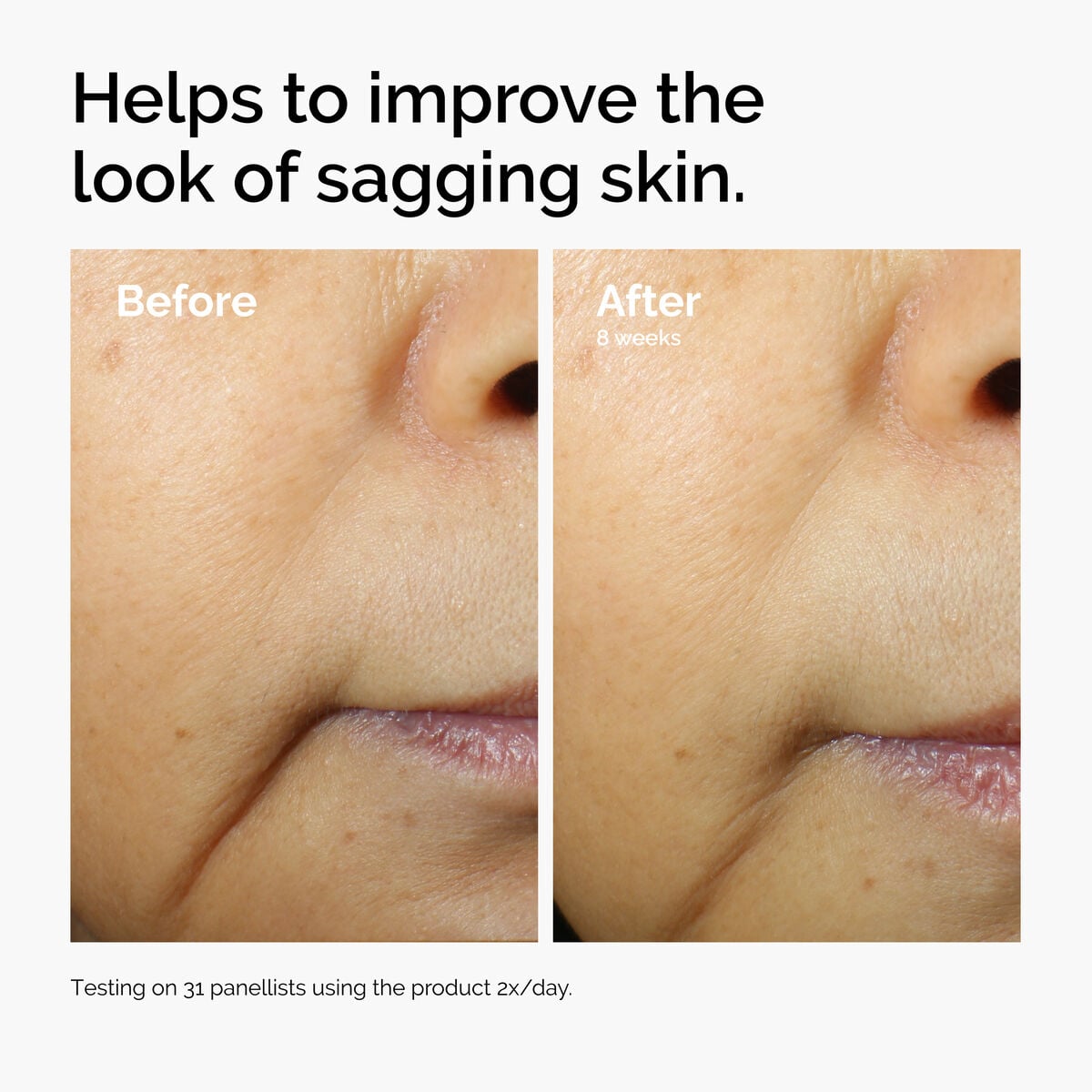 caffeine-3-escin-1-face-serum-m3 ord-caffeine-3pct-escin-1pct-face-serum-before-after-sagging.jpg