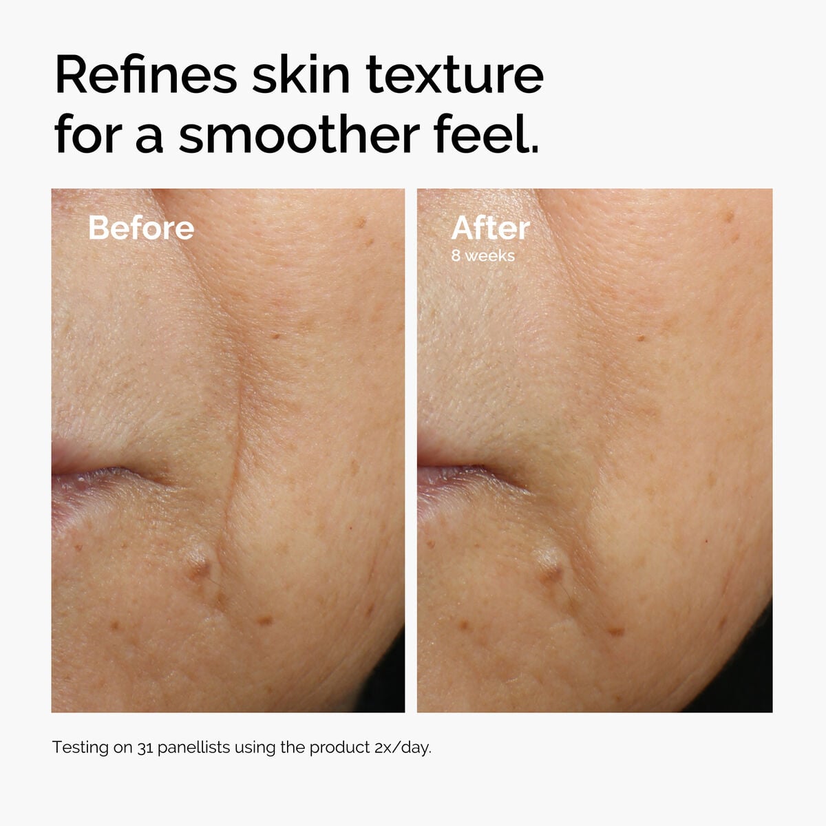 caffeine-3-escin-1-face-serum-m3 ord-caffeine-3pct-escin-1pct-face-serum-before-after-texture.jpg