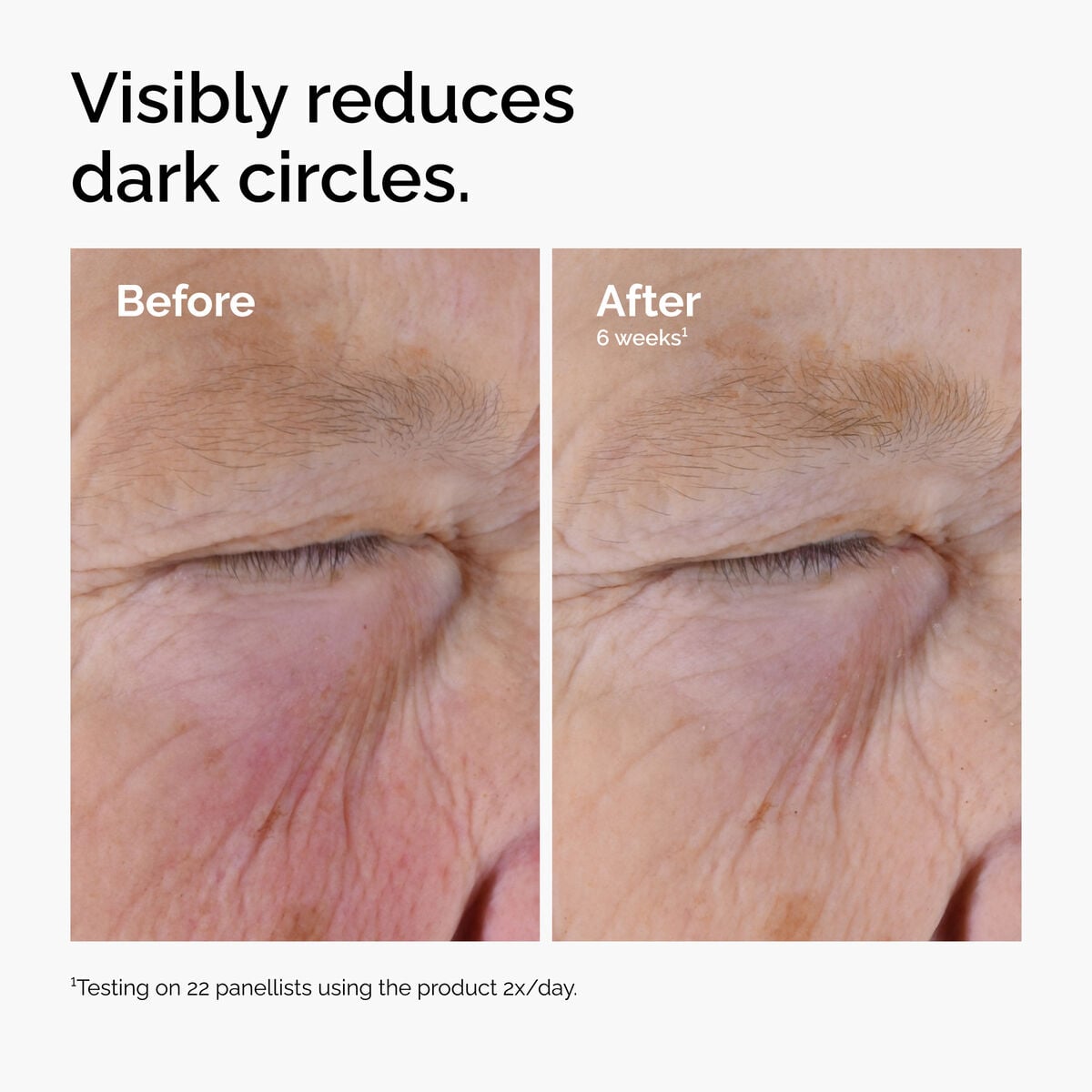 caffeine-solution-5-egcg-eye-serum-m4 ord-caffeine-solution-egcg-dark-circles-before-after.jpg