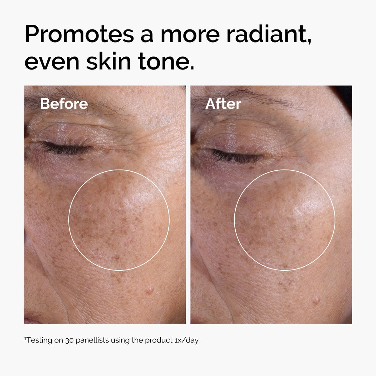 glycolic-acid-7-exfoliating-toner-q4 ord-glycolic-before-after-radiance.jpg