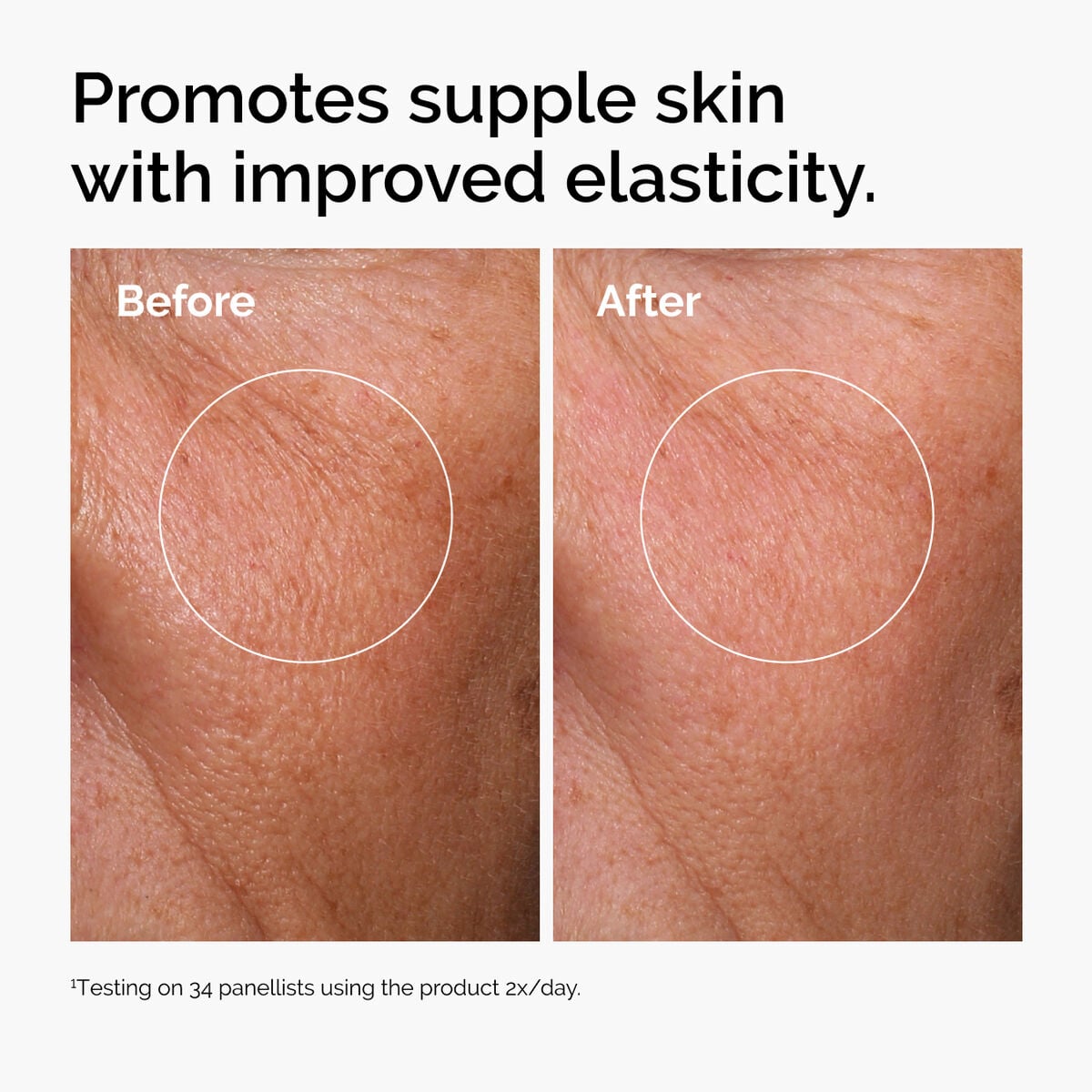 hyaluronic-acid-2-b5-with-ceramides-z6 ord-hyaluronic-acid-2pct-b5-hydrating-serum-before-after-elasticity.jpg