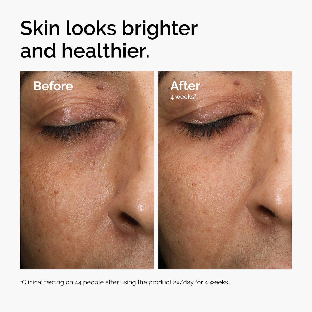 multi-antioxidant-radiance-serum-s0 ord-mars-before-after-healthy.jpg