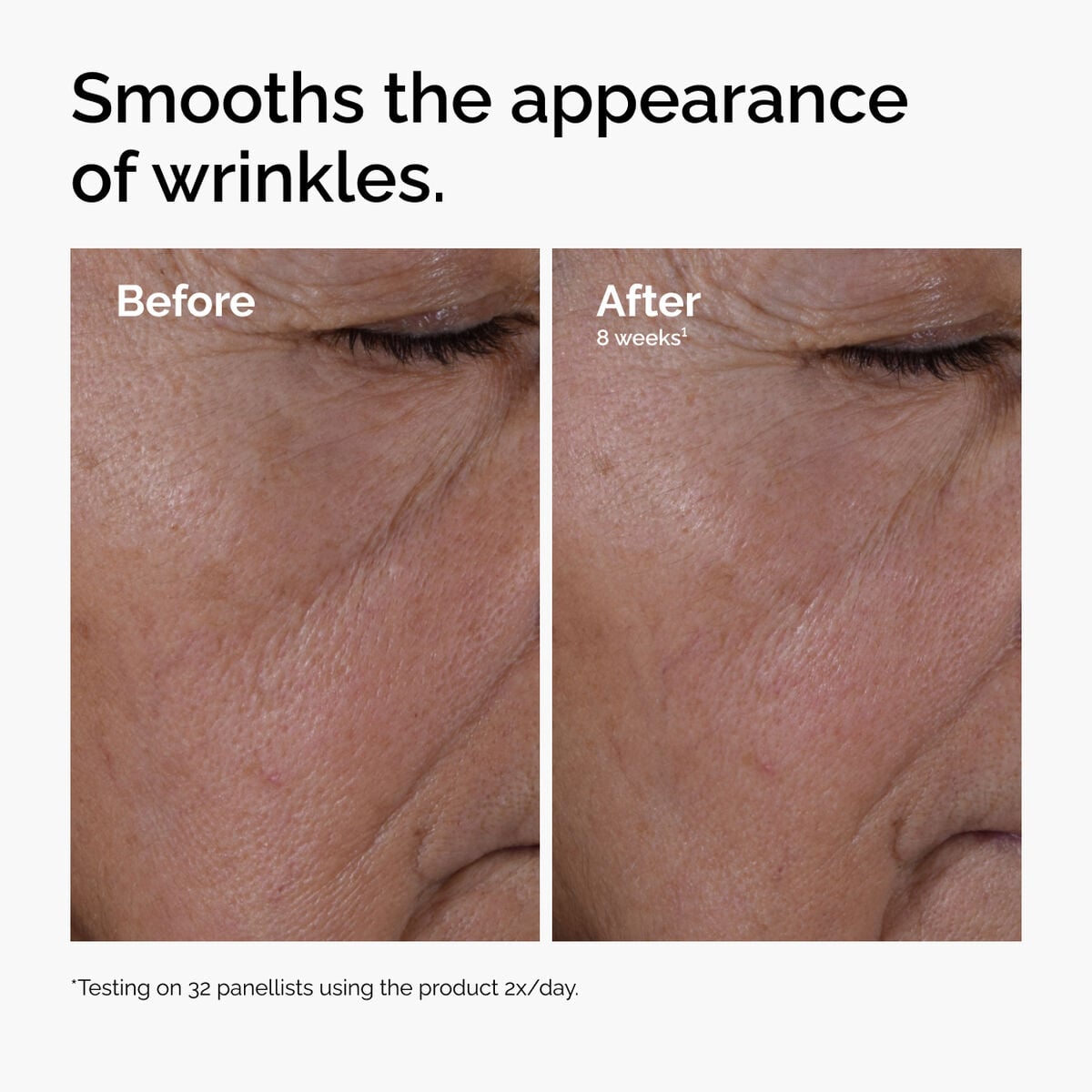 multi-peptide-ha-serum-j4 ord-multi-peptide-ha-serum-wrinkles-before-after.jpg