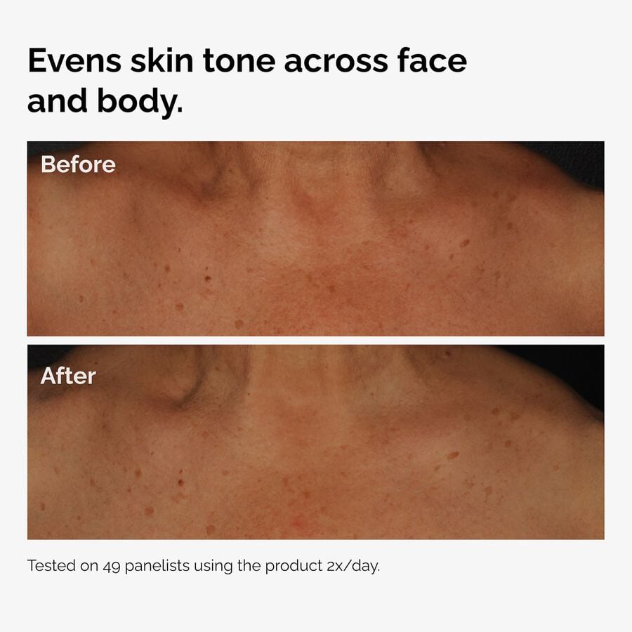 the-body-care-collection-p3 ord-niacinamide-face-body-serum-before-after-even-tone-graphic.jpg