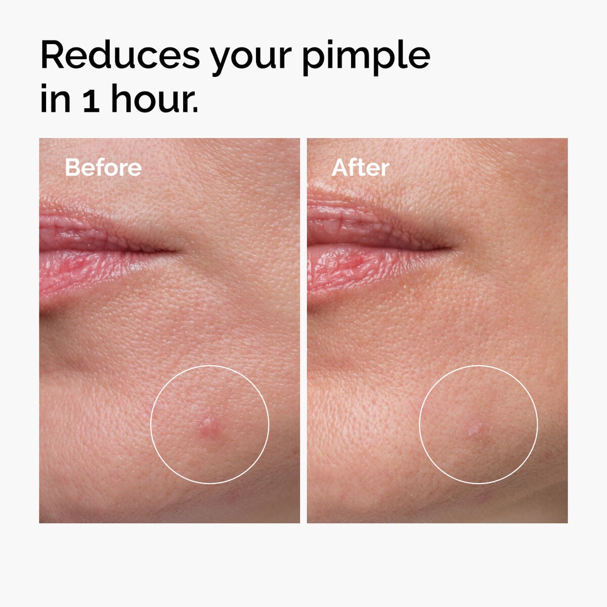 sulfur-10-powder-to-cream-concentrate-b3 ord-sulfur-10pct-powder-to-cream-concentrate-before-after-NA.jpg